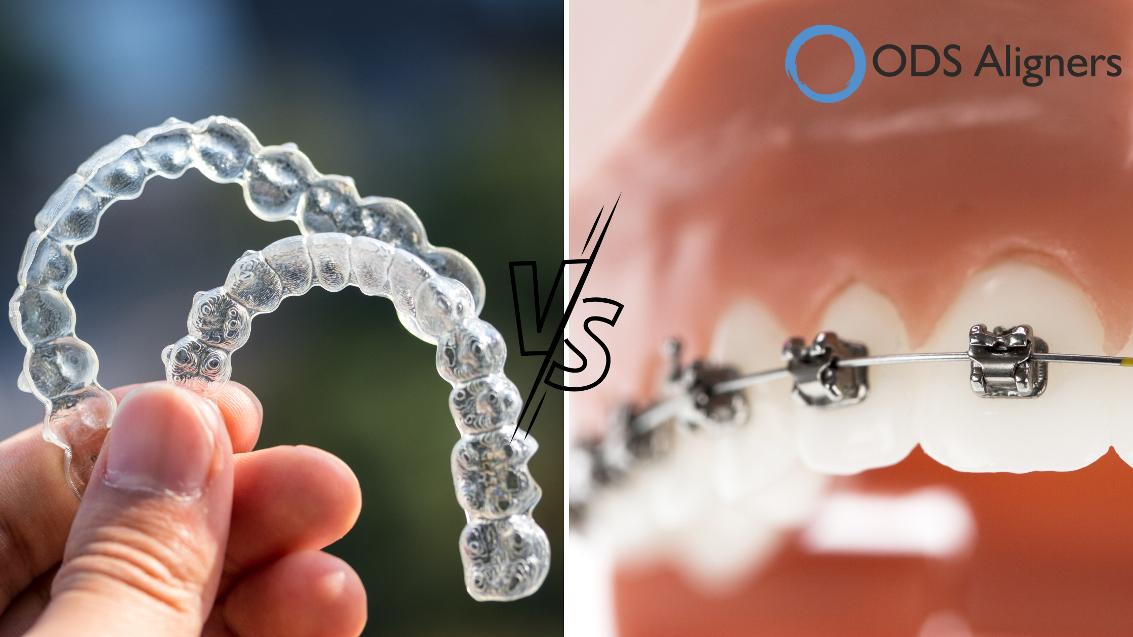 aligner-vs-braces